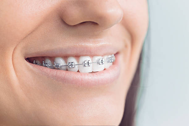 Advanced Technology for Better Dental Care in Bellaire, TX